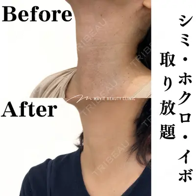 Mavie Beauty Clinic （マヴィービューティークリニック）の症例