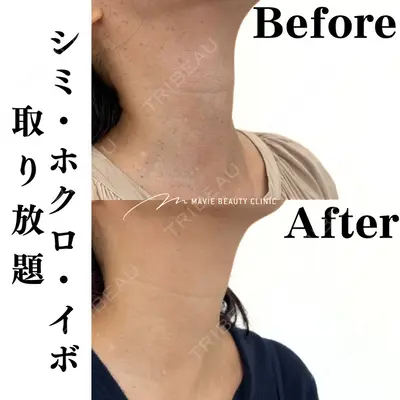 Mavie Beauty Clinic （マヴィービューティークリニック）の症例
