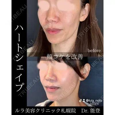 ルラ美容クリニック 札幌大通り院 能登 貴弘医師の症例