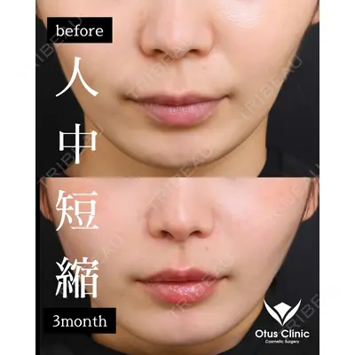 Otus Clinic 【オータスクリニック】 中 徳太郎医師の症例