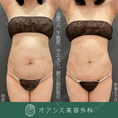 オアシス美容外科の症例