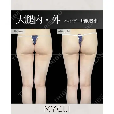 MYCLI【マイクリ】東京・恵比寿院 本田マイケル武史医師の症例