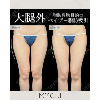 MYCLI【マイクリ】東京・恵比寿院 本田マイケル武史医師の症例