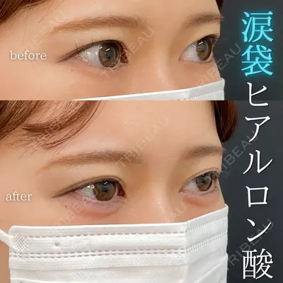 ルラ美容クリニック銀座院 山本 泰輔医師の症例