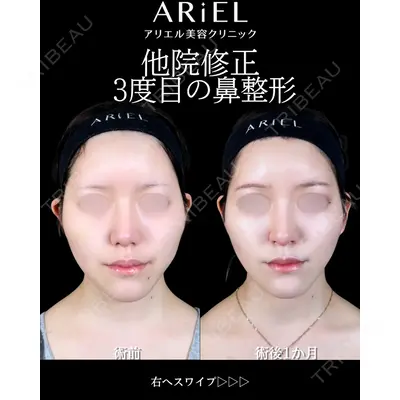 アリエル美容クリニック 大宮院 阪野 一世医師の症例