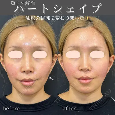 ルラ美容クリニック 仙台院 / ルラスキンクリニック 仙台院 橋本 英樹医師の症例