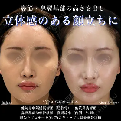 グリシーヌクリニック 藤本 雅史医師の症例