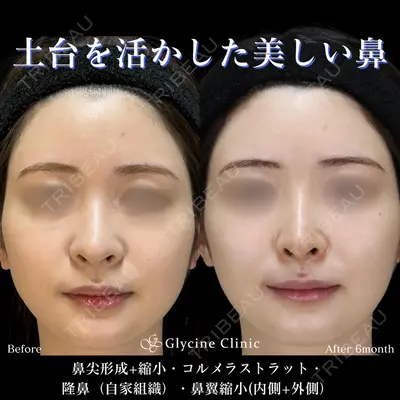 グリシーヌクリニック 藤本 雅史医師の症例