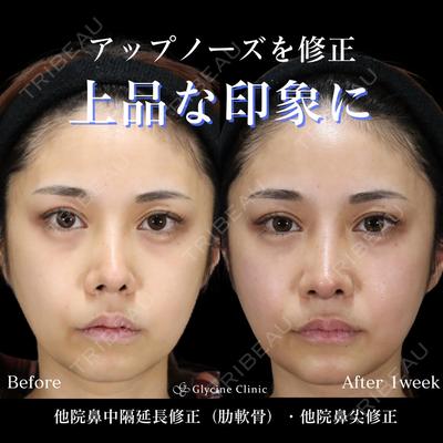 グリシーヌクリニック 藤本 雅史医師の症例