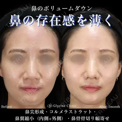 グリシーヌクリニック 藤本 雅史医師の症例