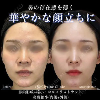 グリシーヌクリニック 藤本 雅史医師の症例