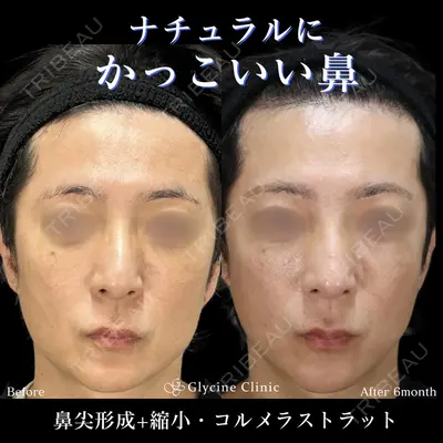 グリシーヌクリニック 藤本 雅史医師の症例