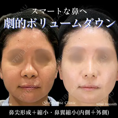 グリシーヌクリニック 藤本 雅史医師の症例