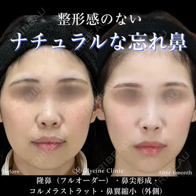 グリシーヌクリニック 藤本 雅史医師の症例