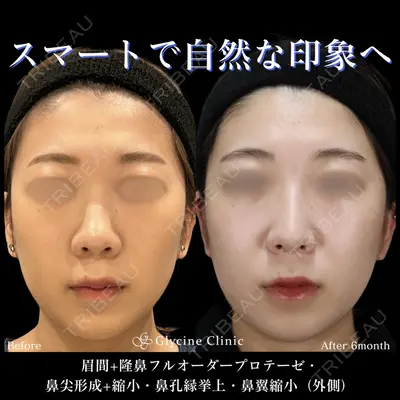 グリシーヌクリニック 藤本 雅史医師の症例