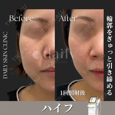 DAILY SKIN CLINIC 心斎橋院の症例