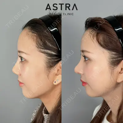 ASTRA BEAUTY CLINIC 塩満 惠子医師の症例