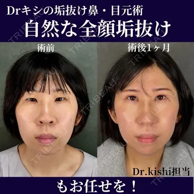ネビュラクリニック 京都院 岸 大輔医師の症例