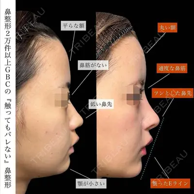 グローバルビューティークリニック 銀座院 理事長　杉崎　裕斗医師の症例