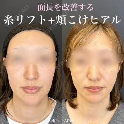 ルラ美容クリニック 名古屋栄院 / ルラスキンクリニック 名古屋栄院 関戸 優医師の症例
