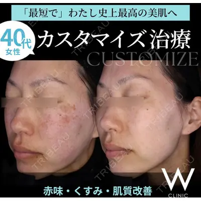 Wクリニック 心斎橋院の症例