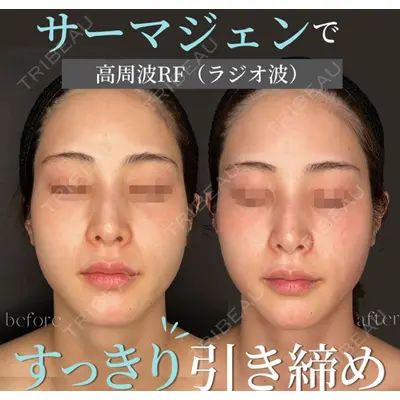 Wクリニック 梅田院の症例