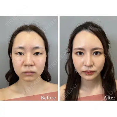 BELINDA CLINIC（ベリンダクリニック）柏院の症例