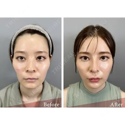 BELINDA CLINIC（ベリンダクリニック）柏院の症例