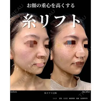 グローバルビューティークリニック 大阪院の症例