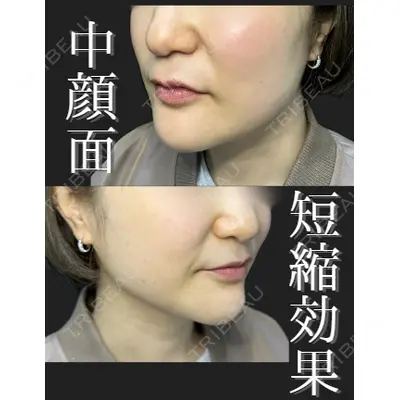ルラ美容クリニック 高田馬場院 若佐 卓矢医師の症例
