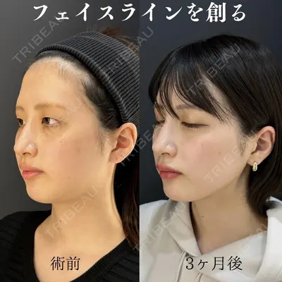 HAAB×DREAM BEAUTY CLINIC 東京本院 吉岡 修一医師の症例