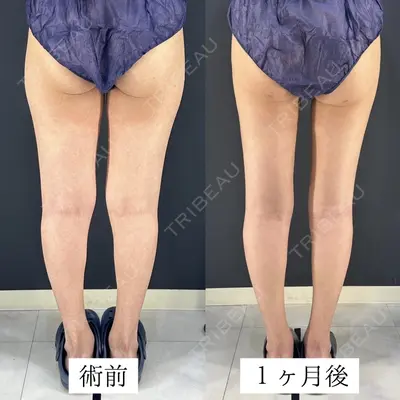 HAAB×DREAM BEAUTY CLINIC 東京本院 吉岡 修一医師の症例
