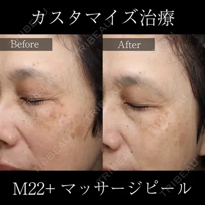 麹町皮ふ科・形成外科クリニック 安藤 玲奈医師の症例