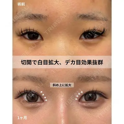 グローバルビューティークリニック 大阪院の症例