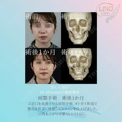 リノクリニック東銀座 宮﨑 邦夫医師の症例