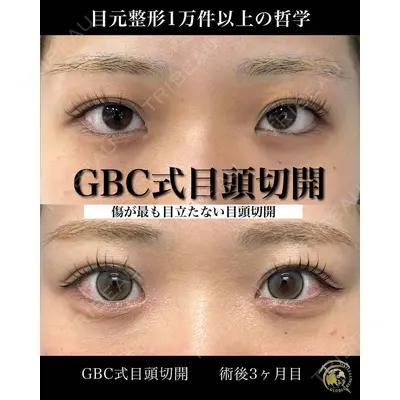 グローバルビューティークリニック 銀座院 理事長　杉崎　裕斗医師の症例