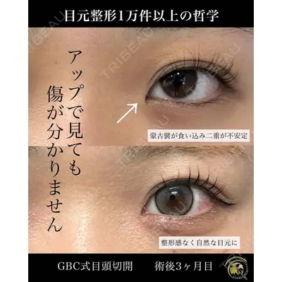 グローバルビューティークリニック 銀座院 理事長　杉崎　裕斗医師の症例