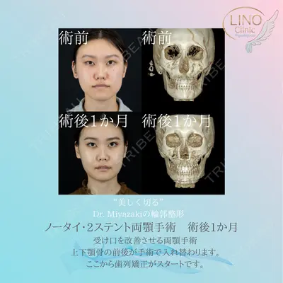リノクリニック東銀座 宮﨑 邦夫医師の症例