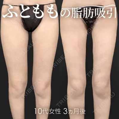 ジョウクリニック 銀座院 重本　譲医師の症例