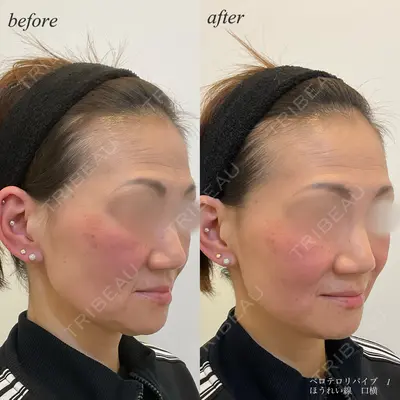 DMTC CLINIC 日本橋院 松井泉医師の症例