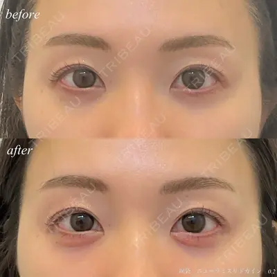 DMTC CLINIC 日本橋院 松井泉医師の症例