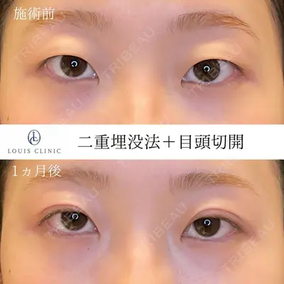 LOUIS CLINIC 二子玉川院【ルイクリニック】 小松 塁医師の症例