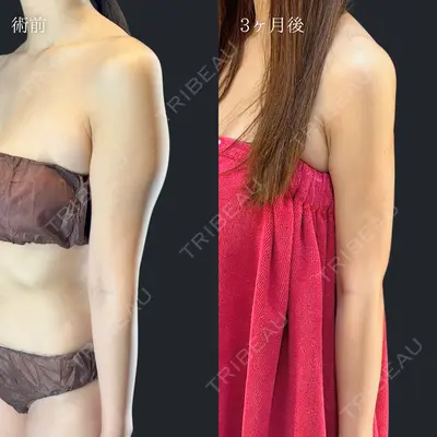 HAAB×DREAM BEAUTY CLINIC 東京本院 吉岡 修一医師の症例