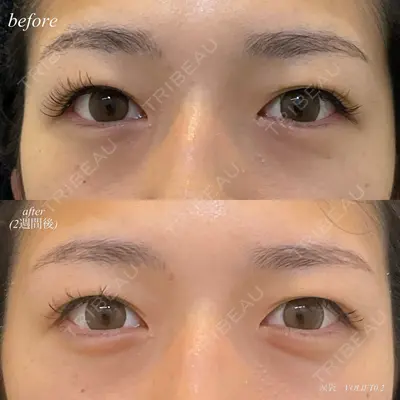 DMTC CLINIC 日本橋院 松井泉医師の症例
