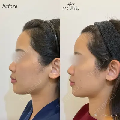DMTC CLINIC 日本橋院 松井泉医師の症例