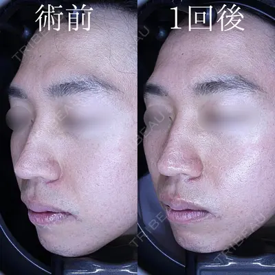 HAAB×DREAM BEAUTY CLINIC 東京本院の症例