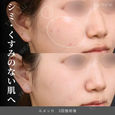 Otus Clinic 【オータスクリニック】 中 徳太郎医師の症例
