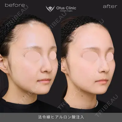 Otus Clinic 【オータスクリニック】 中 徳太郎医師の症例