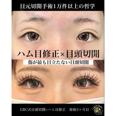 グローバルビューティークリニック 銀座院 理事長　杉崎　裕斗医師の症例