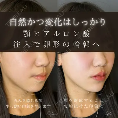 ルラ美容クリニック 大宮院 / ルラスキンクリニック 大宮院 右京 大季医師の症例